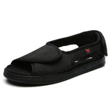 2017Summer dew toe diabetic shoe